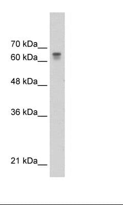 PARP6 Antibody (aa431-480)