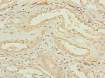 Polyclonal Rabbit anti-Human CEP83 / CCDC41 Antibody (IHC, IF, WB)