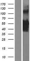 VSX1 Protein (Over-Expression Lysate Myc-DDK (Flag))