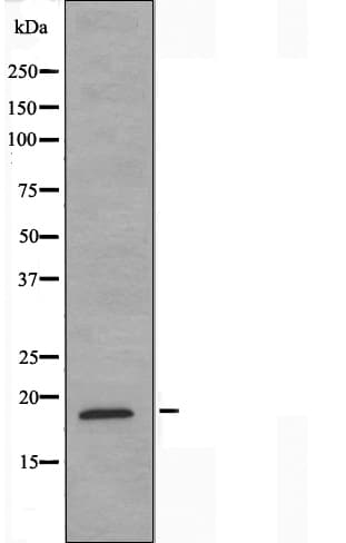 NCBP2 / CBP20 Antibody
