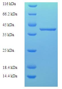 Human TCEANC2 Protein (Recombinant His-SUMO)