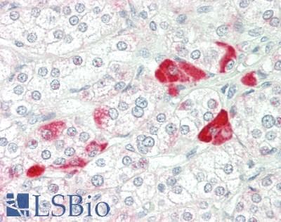 CCL8 / MCP2 Antibody (C-Terminus)