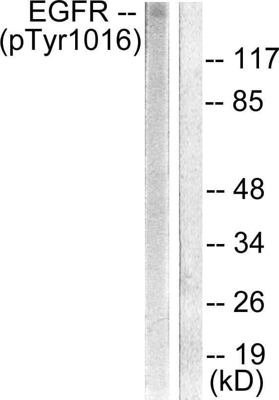 Polyclonal Rabbit anti-Human EGFR Antibody (phospho-Tyr1016, IHC, IF, WB)