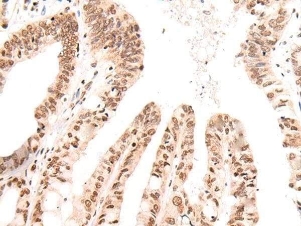 Polyclonal Rabbit anti-Human KNOP1 / C16orf88 Antibody (IHC)
