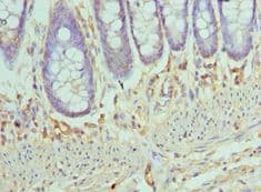 CCL28 / MEC Antibody (aa20-127)