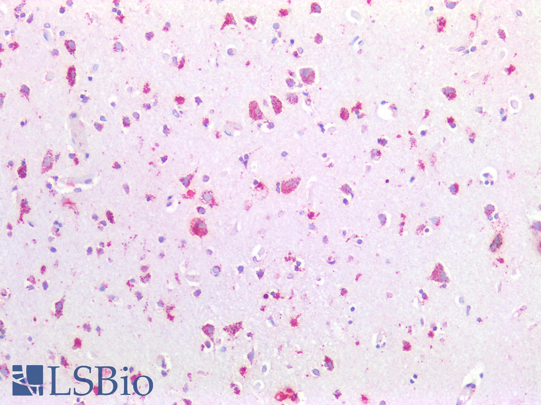 IHC-plus™ Polyclonal Rabbit anti-Human ADGRL1 / LPHN1 Antibody (C-Terminus, IHC)