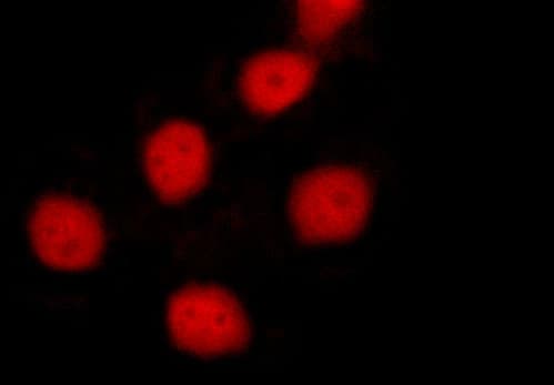 Polyclonal Rabbit anti-Human BIRC5 / Survivin Antibody (IHC, IF, WB)