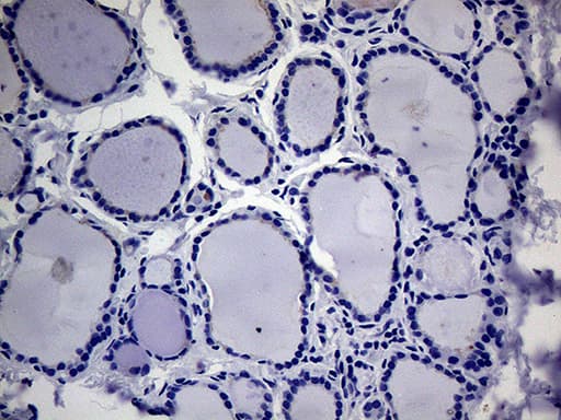 ACVR2 / ACVR2A Antibody (aa214-513, clone OTI1F2)