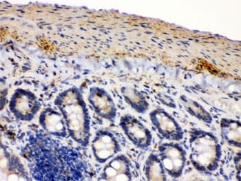 Polyclonal Rabbit anti-Human IDH2 Antibody (IHC, WB)