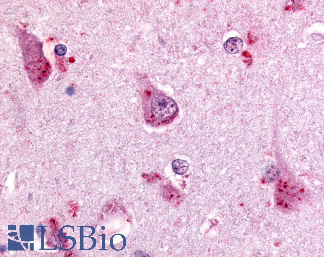 IHC-plus™ Polyclonal Rabbit anti-Human GPR68 / OGR1 Antibody (C-Terminus, IHC)