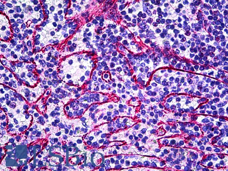 IHC-plus™ Polyclonal Rabbit anti-Human TIE1 / TIE Antibody (Internal, IHC)