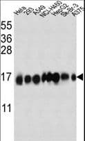 Polyclonal Rabbit anti-Human Fragilis / IFITM3 Antibody (aa1-30, IF, WB)