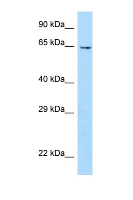 Polyclonal Rabbit anti-Mouse UBOX5 Antibody (aa301-350, WB)
