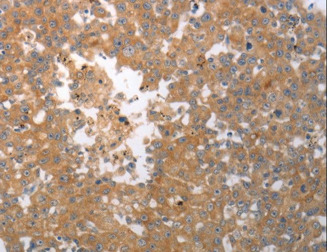 SHH / Sonic Hedgehog Antibody