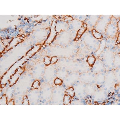 MAPK8 / JNK1 Antibody (phospho-Thr183)