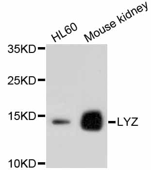 LYZ / Lysozyme Antibody