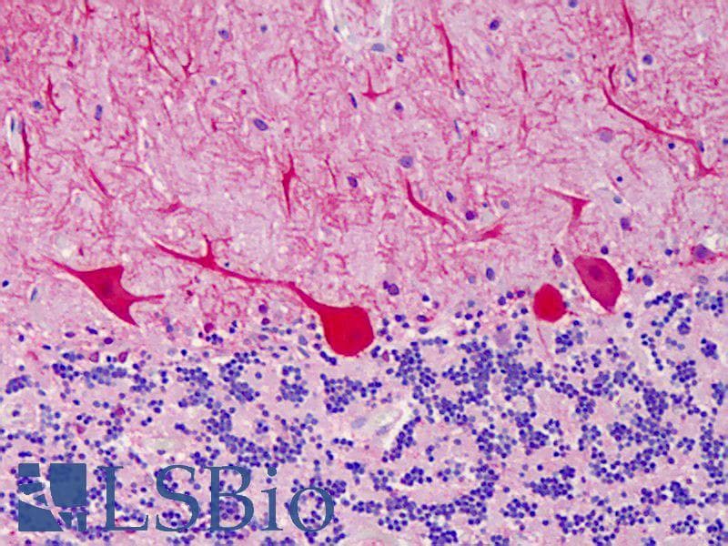IHC-plus™ CARMA1 / CARD11 Antibody
