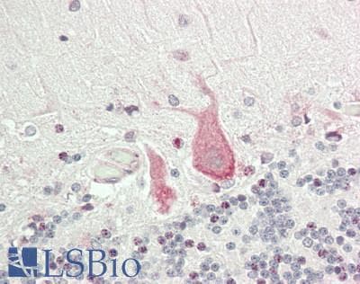 IHC-plus™ TLR4 Antibody (aa421-470)
