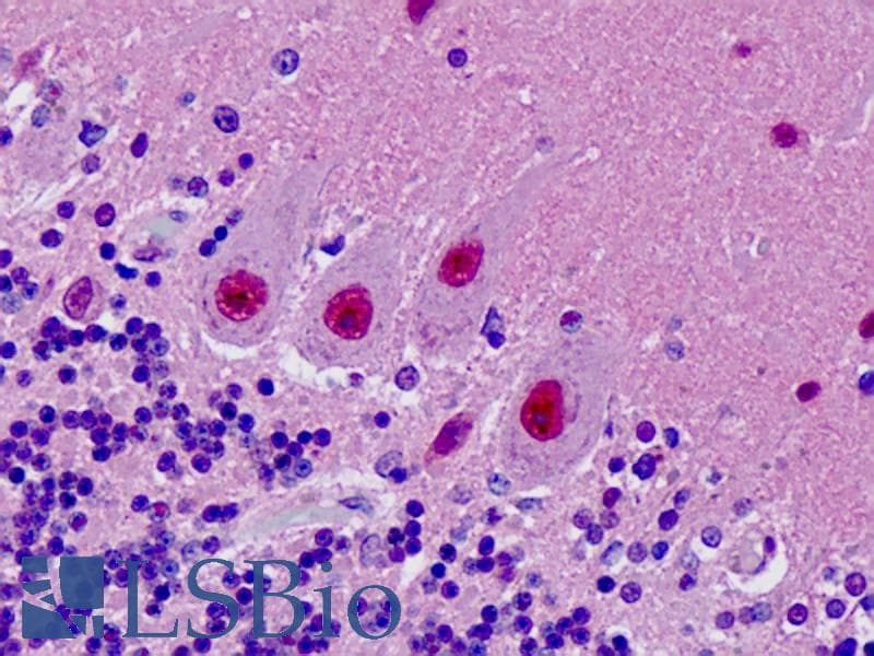 IHC-plus™ MYT1 Antibody (aa41-90)