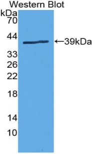 SLC6A3 / Dopamine Transporter Antibody (aa562-620)