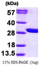 Human GAMT Protein (Recombinant His)