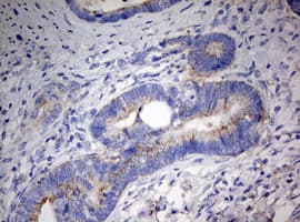 PARN Antibody (aa1-266, clone OTI4D12)