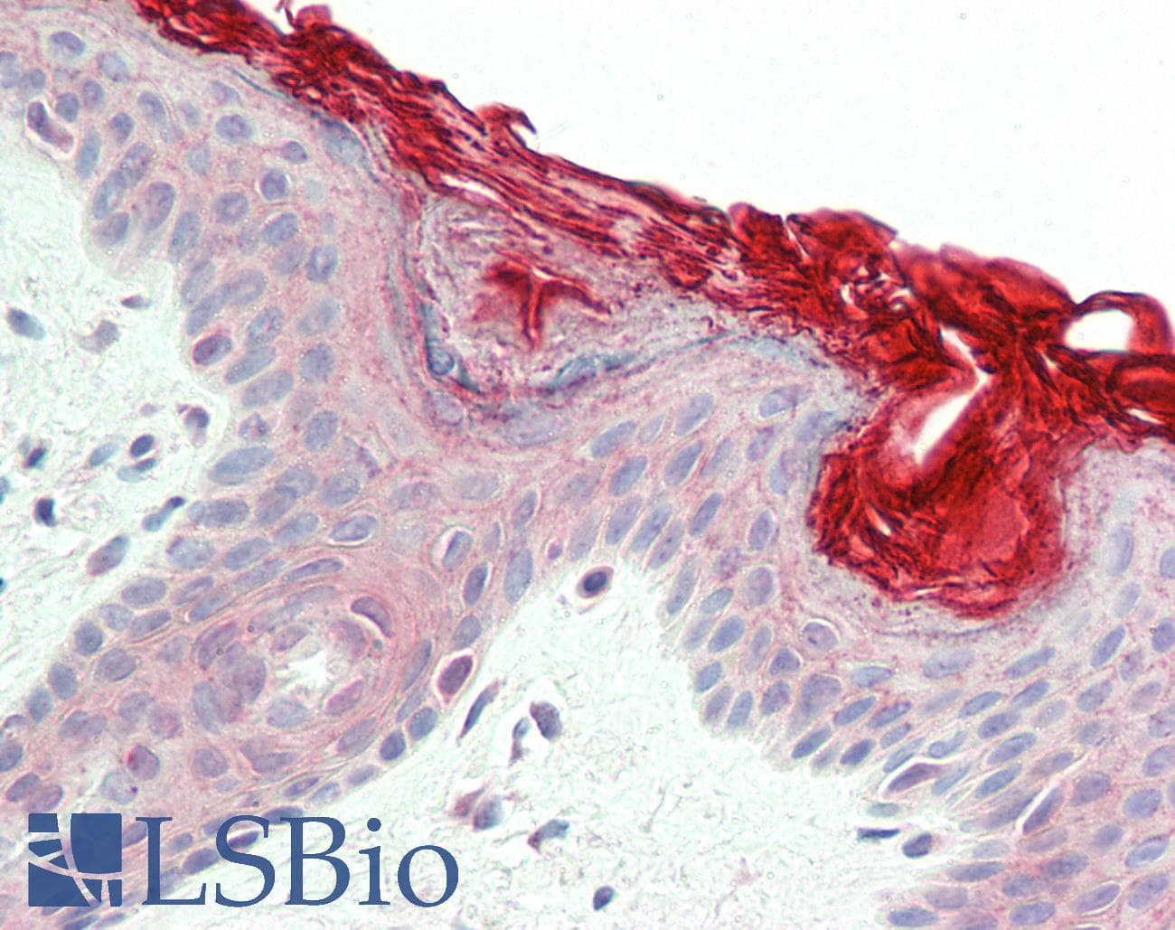 IHC-plus™ Polyclonal Goat anti-Human PERP Antibody (aa172-185, IHC, WB)