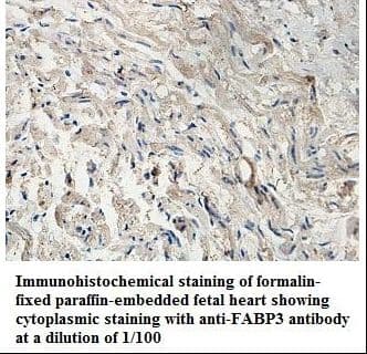 FABP3 / H-FABP Antibody (aa1-133)