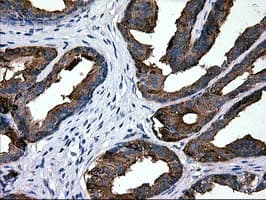 Monoclonal Mouse anti-Human MAC-2-BP / LGALS3BP Antibody (clone OTI6B7, IHC, WB)