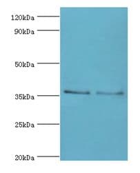 Polyclonal Rabbit anti-Human HOXA1 Antibody (aa75-205, IHC, WB)