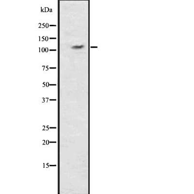 ERN1 / IRE1 Antibody