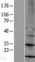 MRPS14 Protein (Over-Expression Lysate Myc-DDK (Flag))