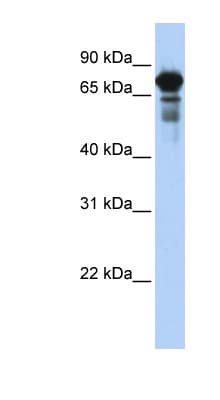 Polyclonal Rabbit anti-Human TRIM29 Antibody (C-Terminus, IHC, WB)