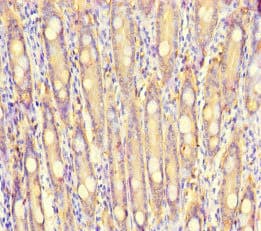 S100G / CABP9K Antibody