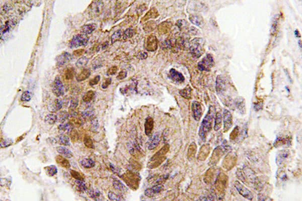 Polyclonal Rabbit anti-Human DATF1 / DIDO1 Antibody (Ser186, IHC, WB)