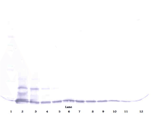 Polyclonal Goat anti-Human CCL16 / LEC Antibody (WB)