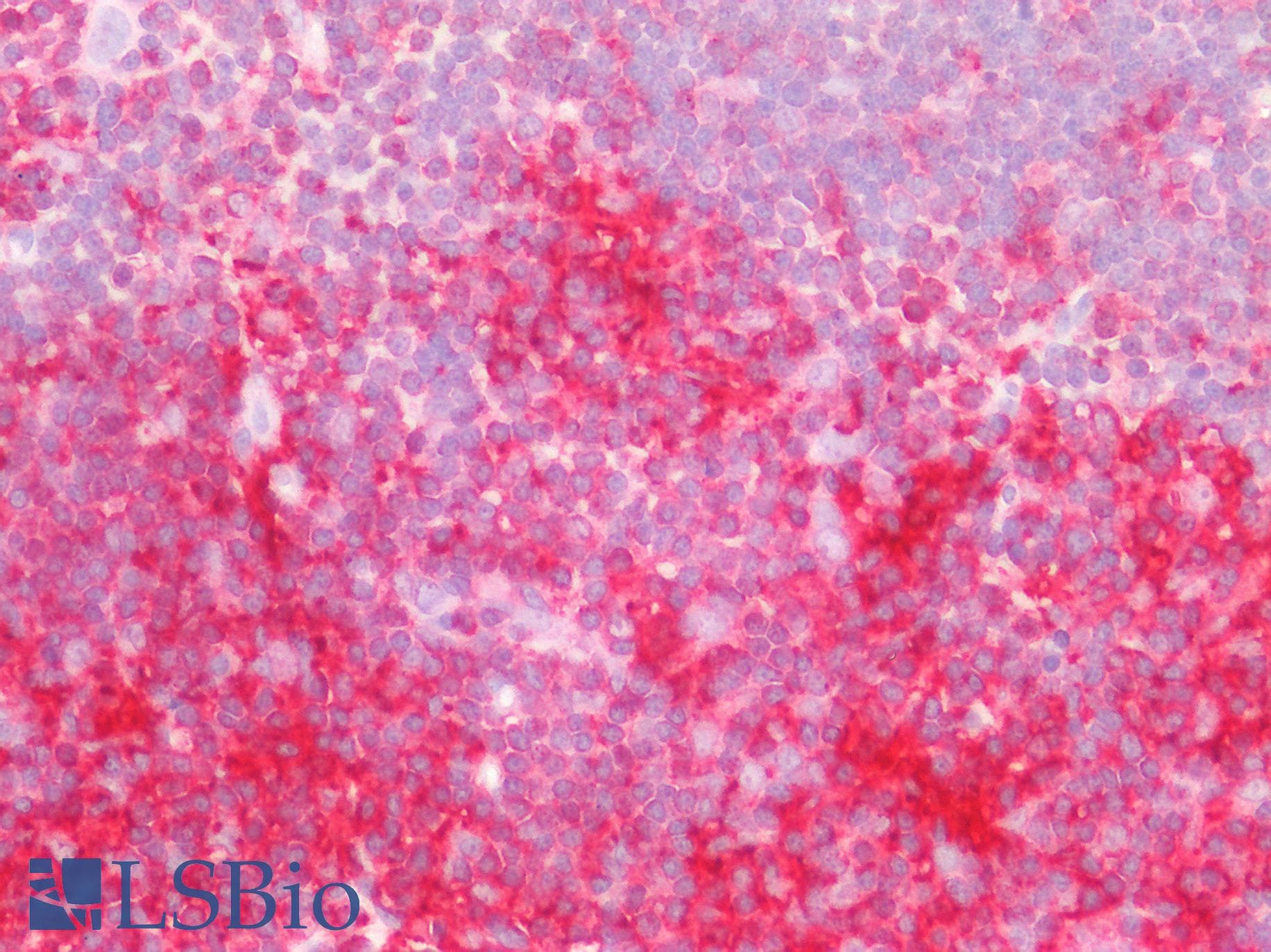 PathPlus™ LSP1 Antibody (aa445-459)