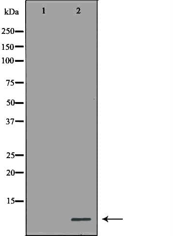 MT2A / Metallothionein 2A Antibody