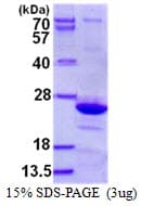 Human EMCN / Endomucin Protein (Recombinant His)