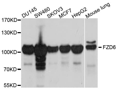 FZD6 / Frizzled 6 Antibody