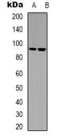 Polyclonal Rabbit anti-Human LTK Antibody (Internal, WB)