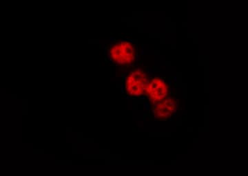 SMAD3 Antibody (phospho-Ser425)