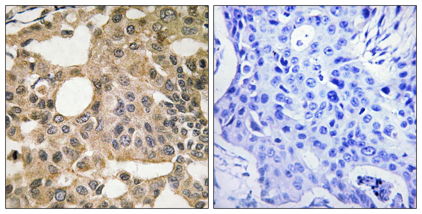 Polyclonal Rabbit anti-Human BCL2L1 / BCL-XL Antibody (Ab-115, IHC)