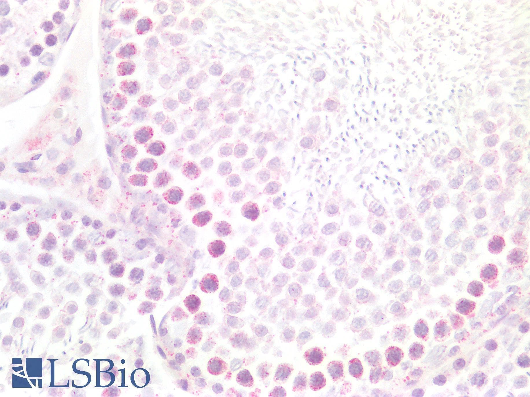 IHC-plus™ CD95 / FAS Antibody (N-Terminus)
