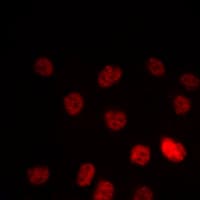 PPARG / PPAR Gamma Antibody (Internal)