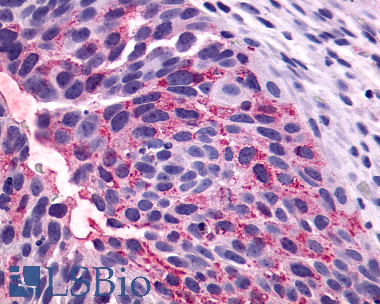 PathPlus™ NTSR1 / NTR Antibody (Cytoplasmic Domain)