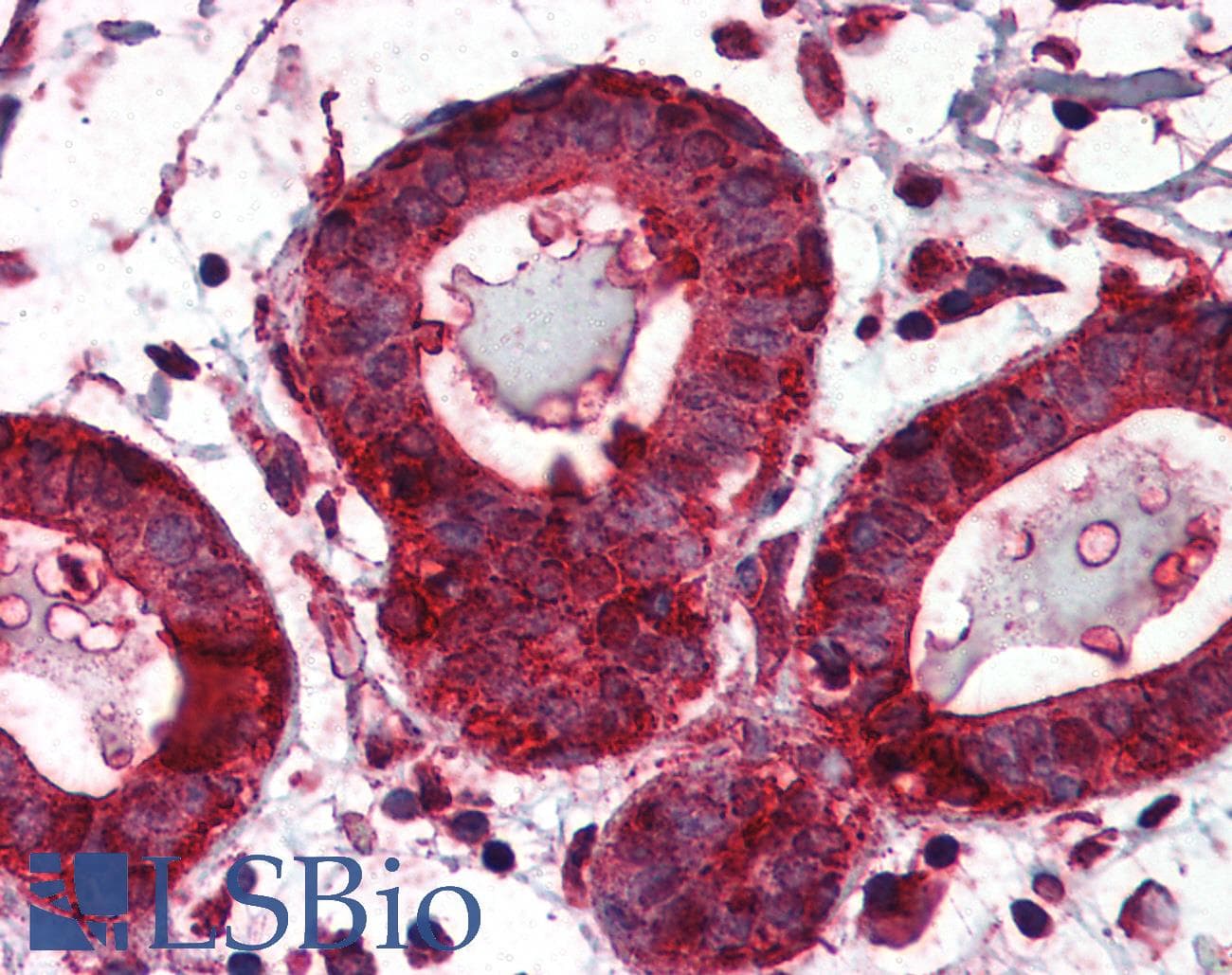 IHC-plus™ Monoclonal Mouse anti-Human HSP90B1 / GP96 / GRP94 Antibody (clone 2H3, aa676-803, IHC, IF, WB)