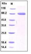 Human CD274 / B7-H1 / PD-L1 Protein (Recombinant)