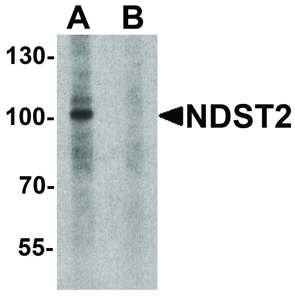 IHC-plus™ Polyclonal Rabbit anti-Human NDST2 Antibody (IHC, IF, WB)