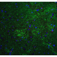 Mitofusin 2 / MFN2 Antibody